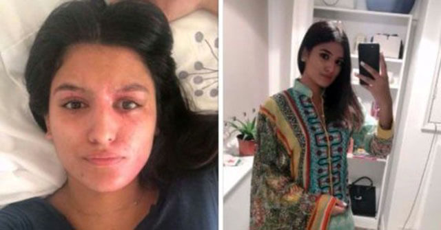 BBC ger sminktips till kvinnor som utsatts för syraattacker