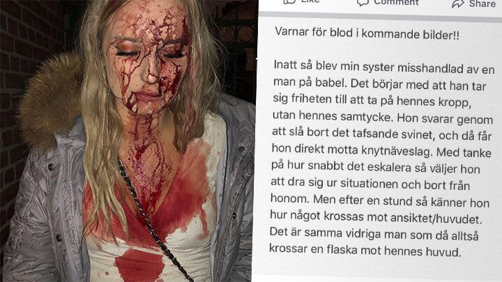 Sophie, 19, försvarade sig mot tafsare på krogen – slogs blodig med flaska