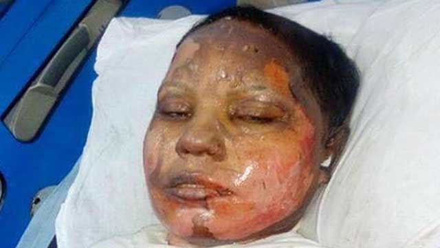 Kristen kvinna nekade muslimsk friare – brändes