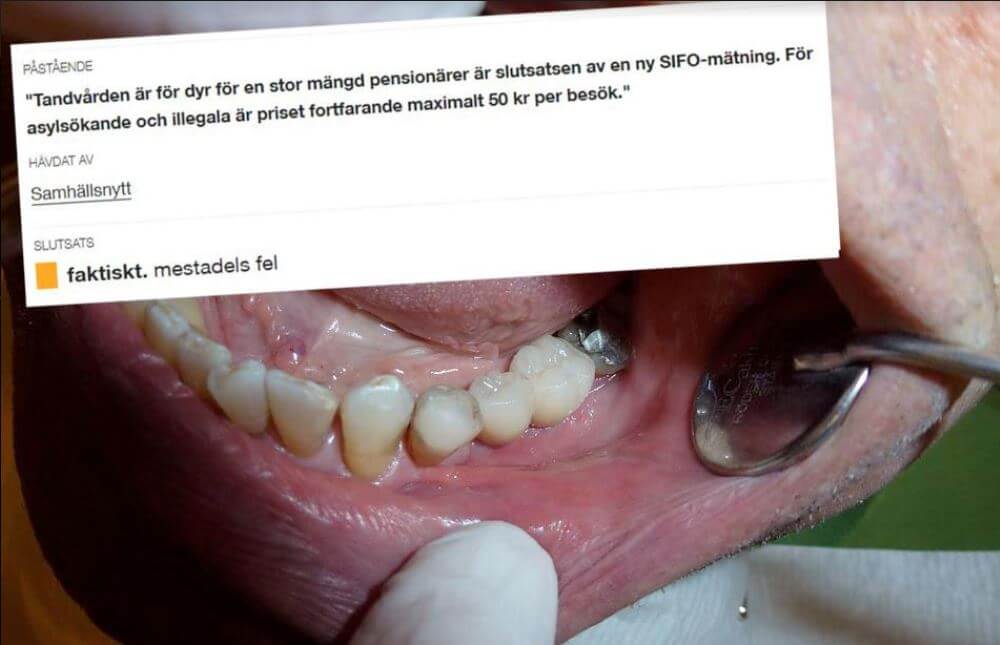 Statsfinansierad faktakoll vilseleder om tandvård för illegala: ”Mestadels fel”
