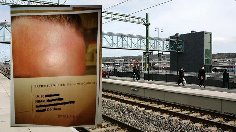 Hävdade invandrarmisshandel – med hjälp av falska bilder: ”Jag ville få större spridning”