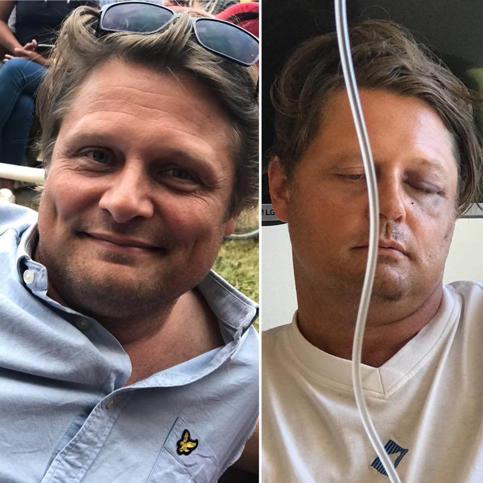 Kvinna ryter till mot invandrare efter överfall med krossade kindben och käke mot hennes man: ”Han kämpar för mångfald i sin vardag”