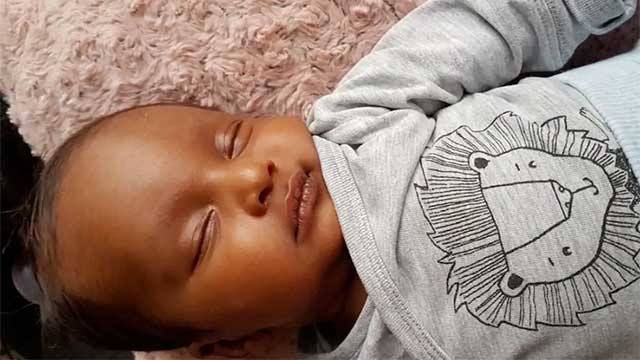 Muslimsk omskärelse gick snett – tvåmånaders pojkes penis helt sönderbränd