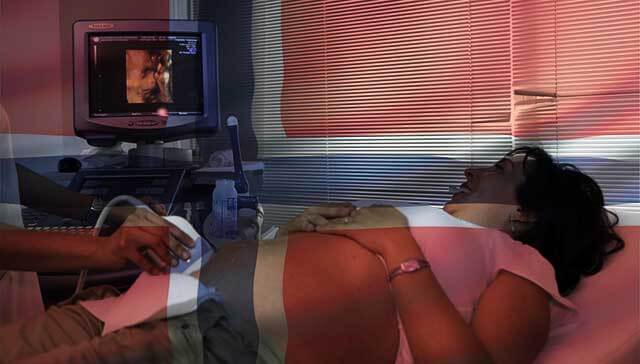 Feminister i Norge demonstrerade för rätten att abortera barn med Downs syndrom