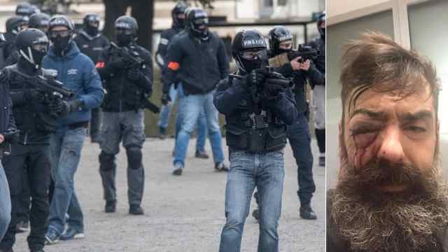 Gula västarnas ledare beskjuten av polis – kommer förlora ena ögat