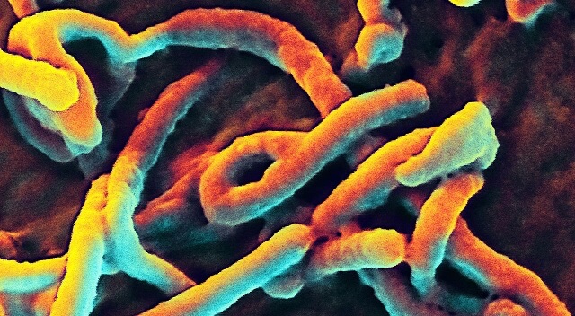 Misstänkt fall av Ebolasmitta i Enköping – akutmottagning nedstängd