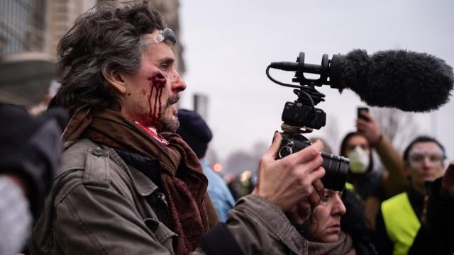 UPPGIFTER: Fransk polis beskjuter frilansjournalister – flera skadade