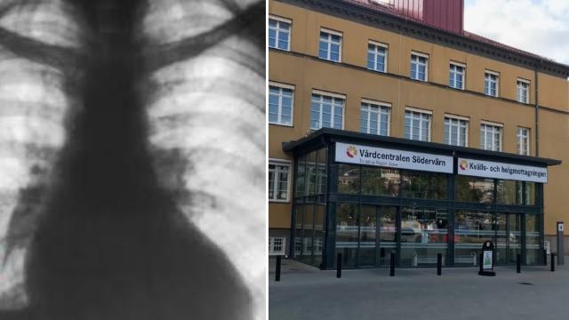 Läkare bedömde andningssvårigheter som ”stress” – hade blodproppar och lunginfarkt