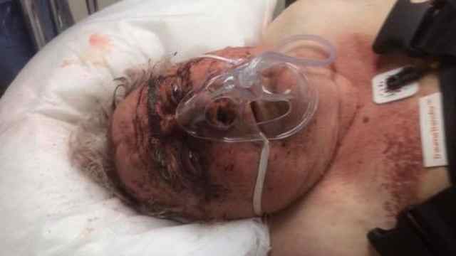 Rånare torterade 83-åring i timmar – slet loss hans öron