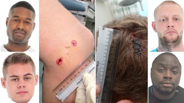 Gäng tortyrrånade tonåring på Rolex: ”Sågade och skar mig i hälsenan”