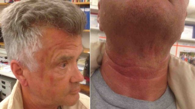 Förälder misshandlade lärare när sonen inte fick högre betyg – frias av tingsrätten