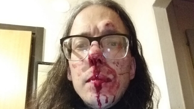 Gatukonstnären Dan Park misshandlad av gäng i Malmö