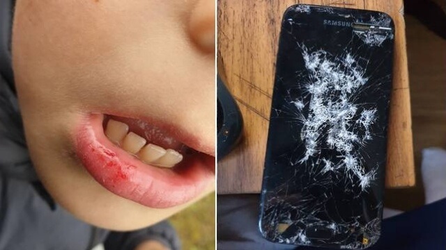 Gäng misshandlade 9-åring blodig vid lekplats – rånades på mobiltelefon