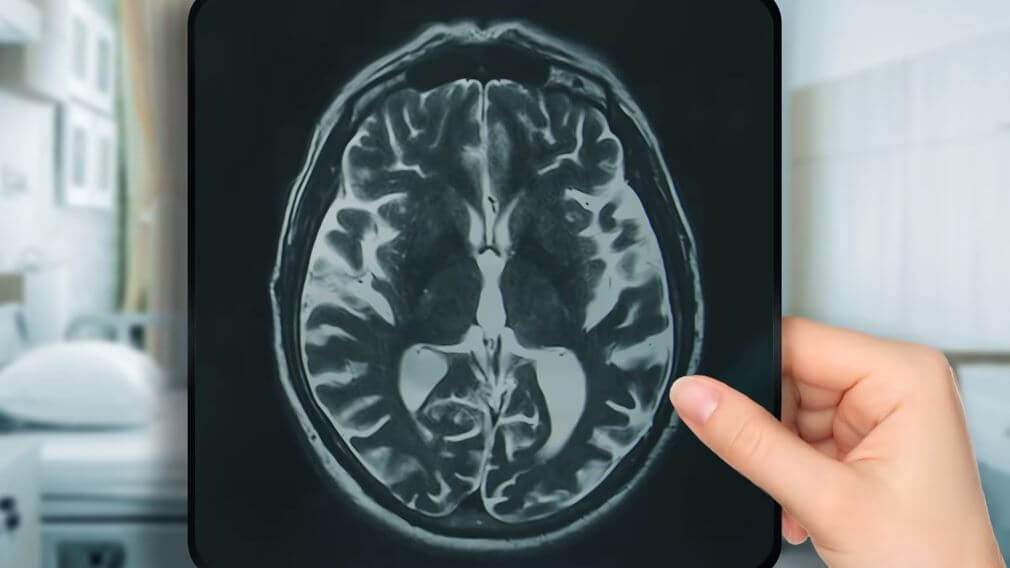 Forskare har utvecklat en dekoder som kan förvandla hjärnaktivitet till tal