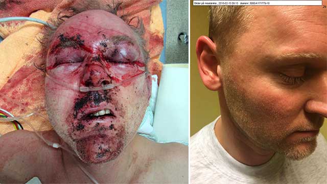 Johan sparkade sönder Magnus huvud – döms till endast ett och ett halvt års fängelse