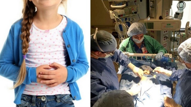 Fyraåring med feber, smärtor och kräkningar skickades hem med ”halsfluss” – hade brusten blindtarm