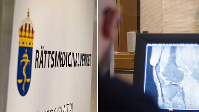 Aktivistorganisationer JK-anmäler medicinsk åldersbestämning av ’ensamkommande’