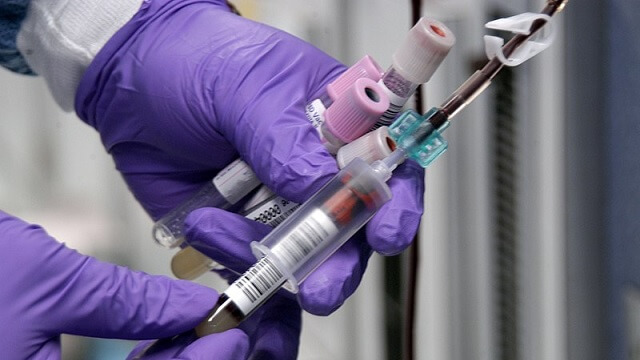 Vårdmottagning kan ha smittat 200 med syfilis