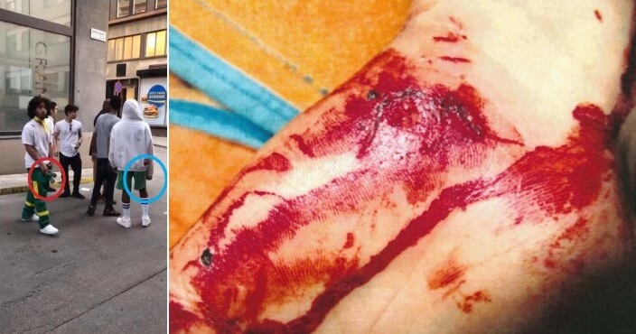 Åtal mot Rocky: Rapstjärnan ska ha försökt hugga offret i ansikte med glasflaska