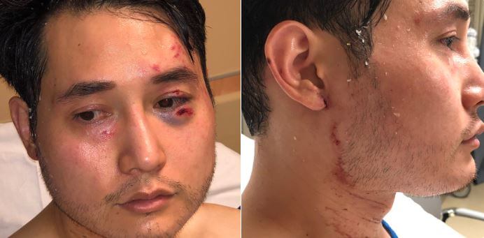 Amerikansk journalist attackerad av vänsterextremister – fick hjärnblödning