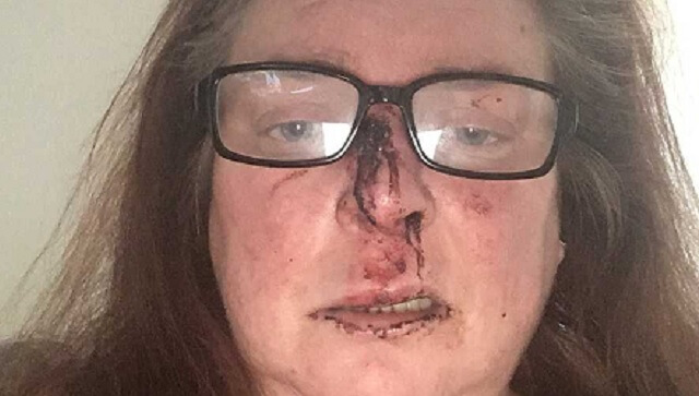 Stor rädsla i Lilla Edet – kvinnor med hundar attackeras och misshandlas