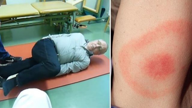 Borreliapatient avfärdades med värktablett – fick bestående hjärnskador