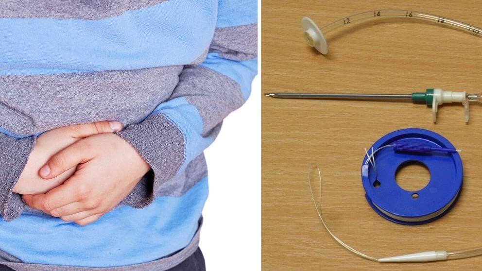 Funktionshindrad sökte vård för buksmärtor men nonchalerades – skickades hem och avled