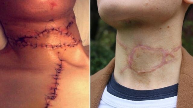 Muslimsk far skar halsen av sin homosexuelle son