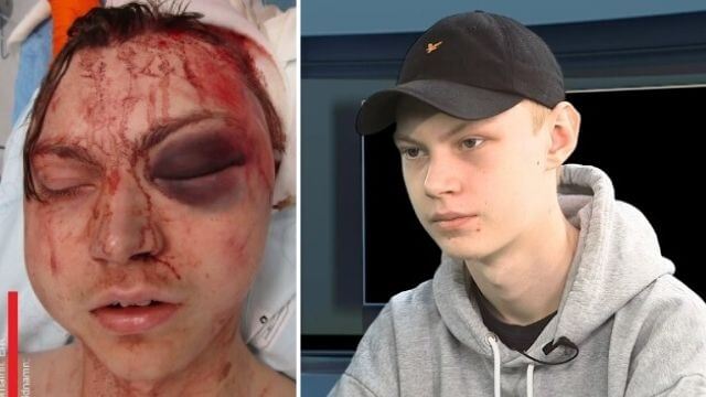 Samnytt TV: Lyssna på tortyroffrens timmar i fångenskap