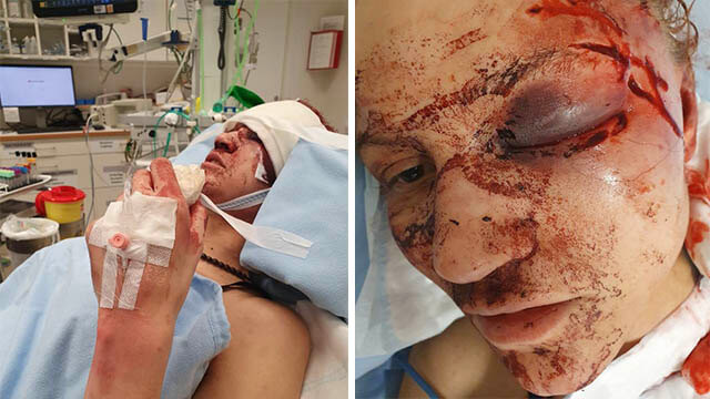 Man anhållen för mordförsök efter misshandel av kvinna