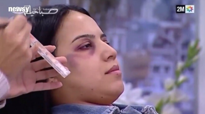 Här lär marockansk tv ut hur kvinnor kan dölja blåmärken efter misshandel