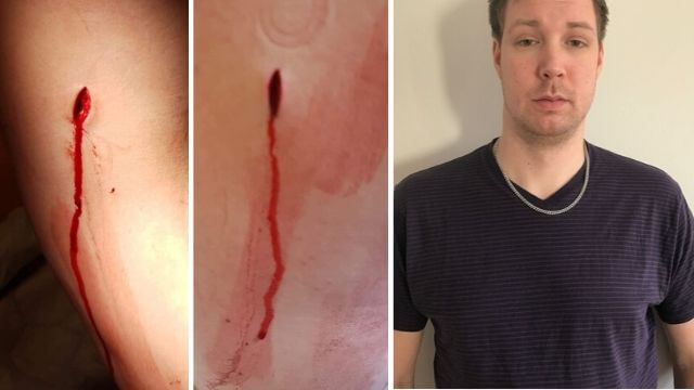 Ricky och vänner bad aggressivt invandrargäng lugna sig – knivhöggs