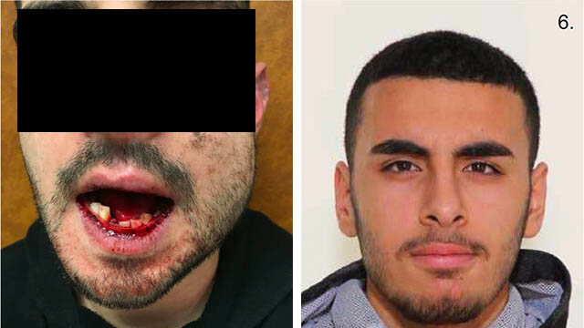 Video: Invandrargäng slår sönder mannens käke och tänder efter att han sagt ifrån om deras äggkastning