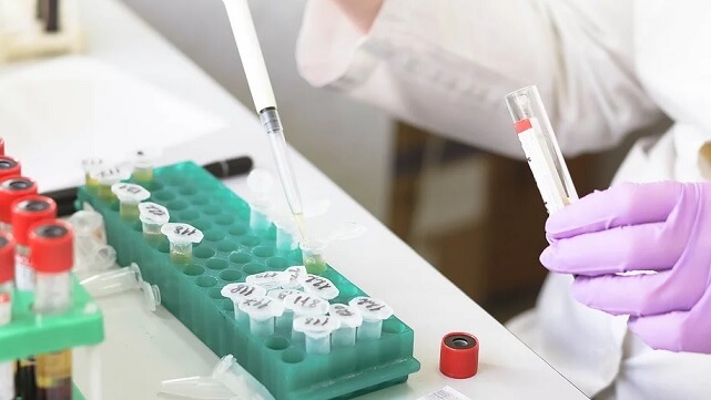 Man med hiv andra personen att botas helt från viruset