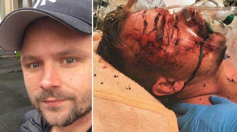 Polisen brände bort Stefans ansikte vid ingripande – inget brott