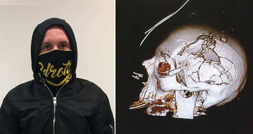 Vänsterextremist försökte mörda slumpmässigt utvalda äldre: ”Stycka en SDare”