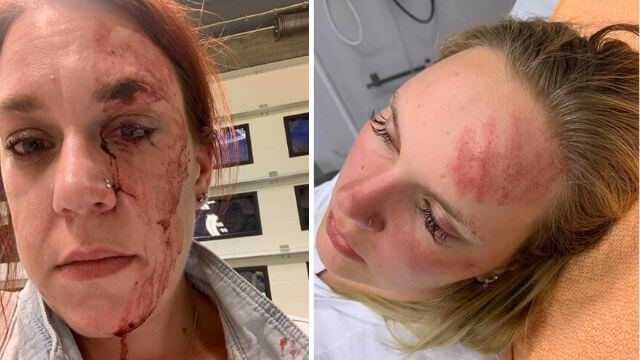 Rebecca och systern stampades i huvudet av invandrare: ”Horungar”