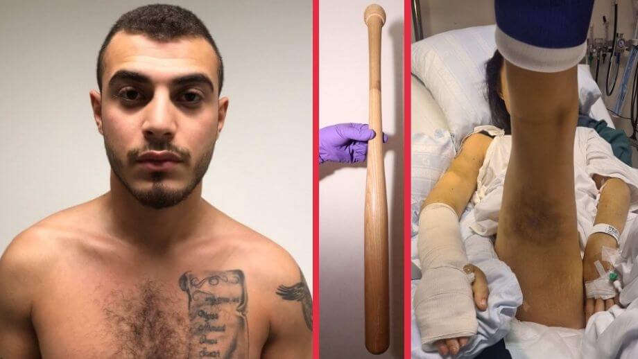 Mohammad torterade flickvännen när hon ville separera – slog sönder 11 ben med basebollträ