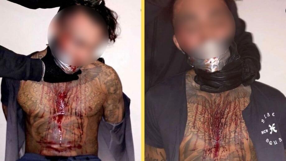 Blodiga bilder på mordmisstänkte Blattelito sprids – uppges vara torterad