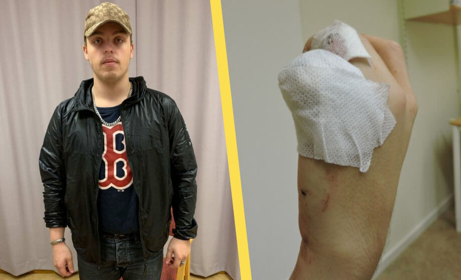 Gäng ville driva in skuld – skar av finger på oskyldig man