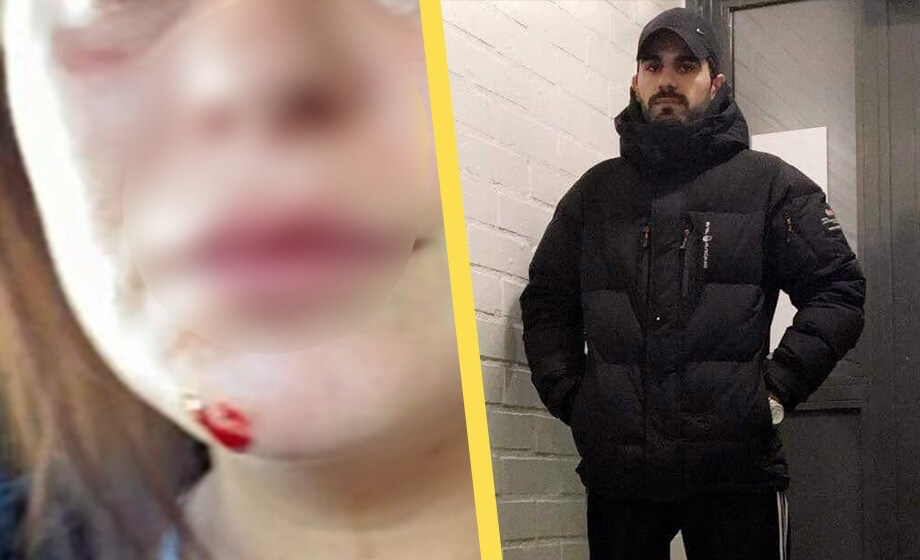 Zeyad brände cigarett i småbarnsmors ansikte – åklagare yrkade inte på utvisning