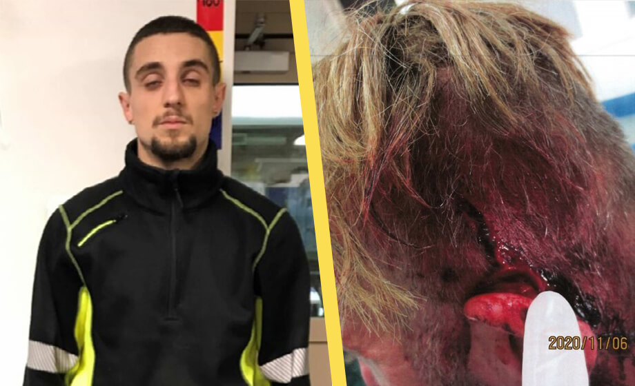 Kosovoalban accepterade inte separation – högg flickvännens släkting med machete