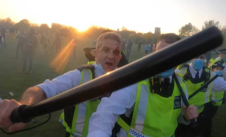 Polis tvingades retirera i sammandrabbning med vårnjutare