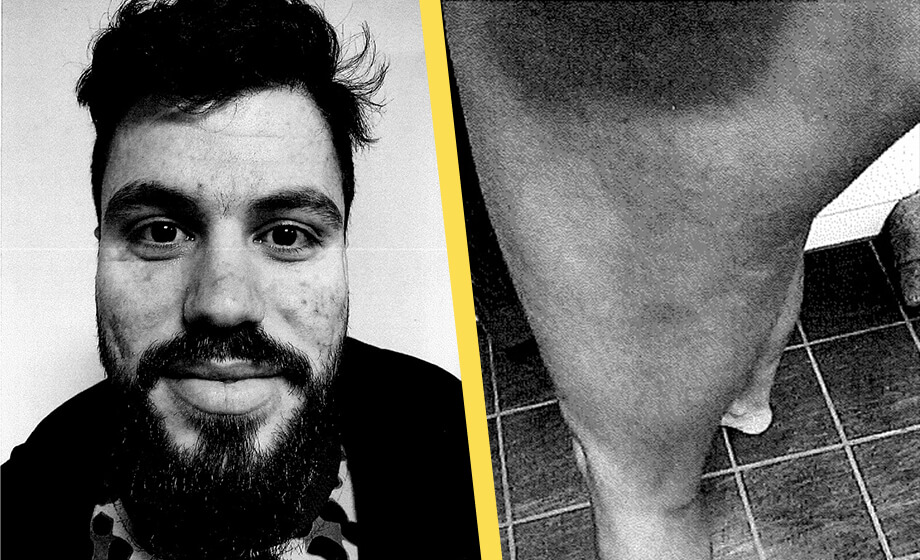 Lorik höll fast kvinna och tryckte in penisen i munnen: ”Ska lära dig vad kvinna betyder”