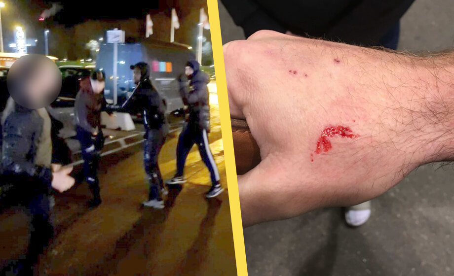 Bad syrier sluta röka vid butik – blev rånad, biten och sparkad i huvudet