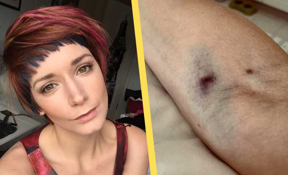 Brittisk modell fick Astra Zenecas vaccin – avled