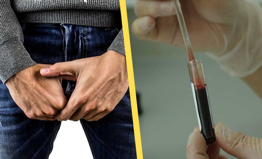 Blod i urin utreddes inte – fick cancer