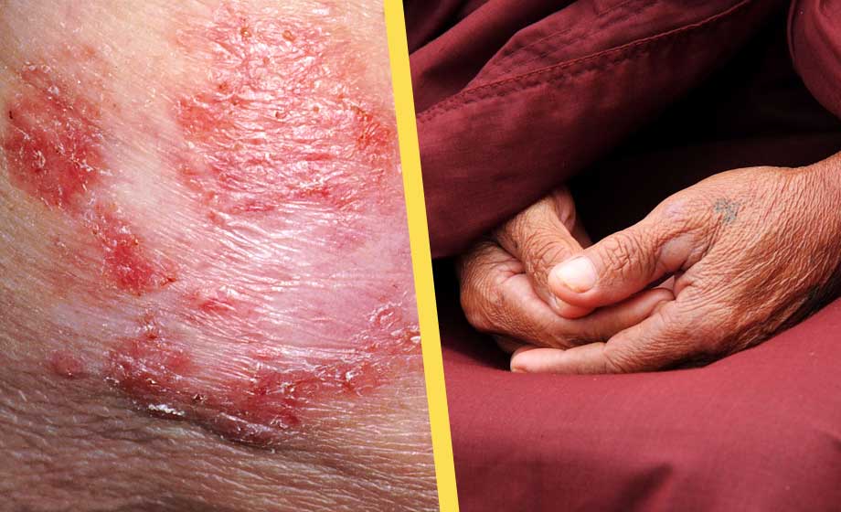 Läkare missade cancer två gånger