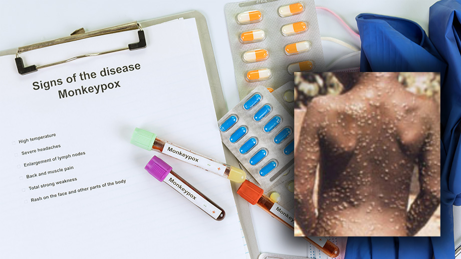 Sverige ska köpa vaccin mot apkoppsvirus