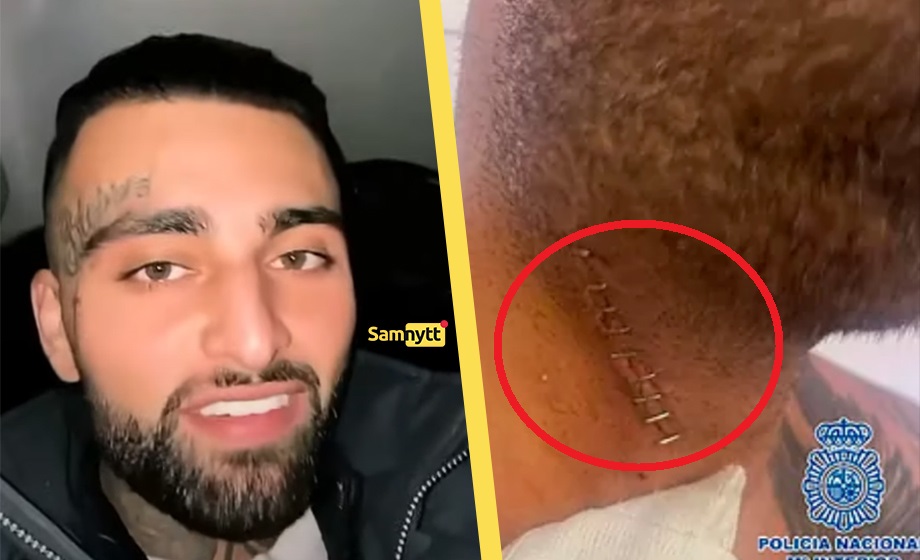 Abbe Blattelito gripen för mordförsök – knivskar offret i halsen